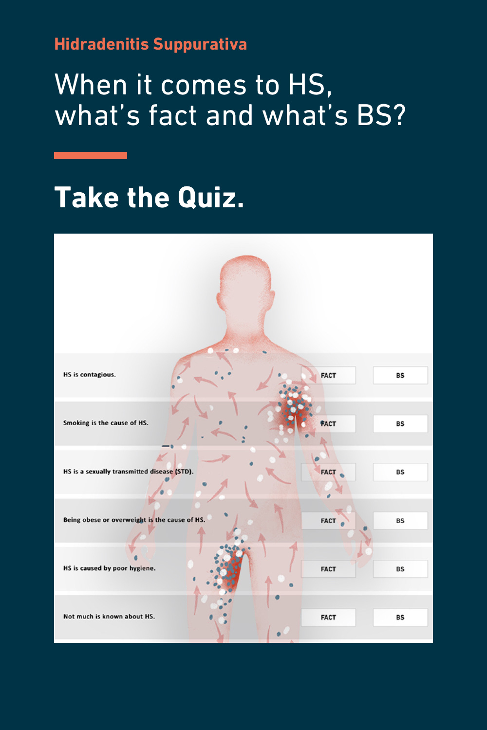 What Is Hidradenitis Suppurativa HS No BS About HS